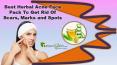 Best Herbal Acne Face Pack to Get Rid of Scars, Marks and Spots