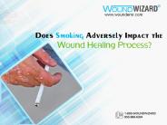 Does Smoking Adversely Impact the Wound Healing Process?