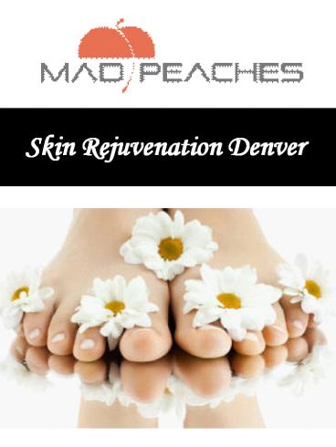 Skin Rejuvenation Denver