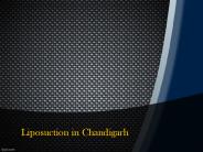 Gynecomastia Surgery in Chandigarh (2)
