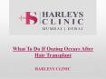 What To Do If Oozing Occurs After Hair Transplant PowerPoint PPT Presentation