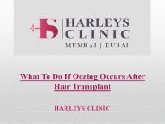 What To Do If Oozing Occurs After Hair Transplant