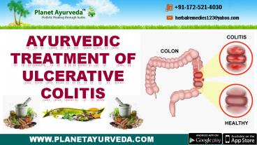 Best Ayurvedic Medicines for Ulcerative Colitis