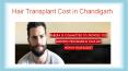 Hair Transplant Cost in Chandigarh PowerPoint PPT Presentation