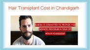 Hair Transplant Cost in Chandigarh