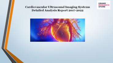 Cardiovascular Ultrasound Imaging Systems