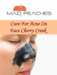 Cure For Acne On Face Cherry Creek