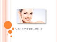 All About Acne Scar Treatment