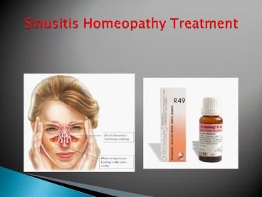 Best Homeopathy Doctors For Sinus In Hyderabad