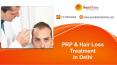 PRP & Hair Treatment in Delhi