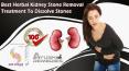 Best Herbal Kidney Stone Removal Treatment to Dissolve Stones