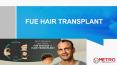 FUE Hair Transplant Clinic in UAE