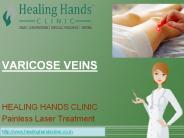 A PPT on Varicose Veins Treatment