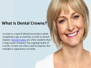 What Is Dental Crowns?