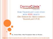 Case Study of Hair Transplantation - 4000 Grafts