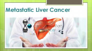 Metastatic Liver Cancer