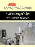 Sun Damaged Skin Treatment Denver PowerPoint PPT Presentation