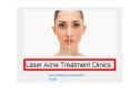 Best Laser Acne Treatment Clinics in London
