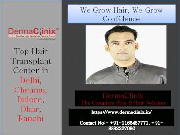 Hair Transplant Surgery in Delhi