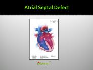 Atrial Septal Defect (ASD)