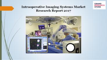 Intraoperative Imaging Systems Market Research Report 2017
