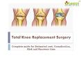 Total Knee Replacement Surgery Cost in India- Complete guide for Estimated cost, Complication, Risk and Recovery time. PowerPoint PPT Presentation
