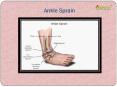 Ankle Sprain : Causes, Symptoms, complications, risk factor, treatment and procedure PowerPoint PPT Presentation