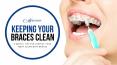 5 Dental Tips for Keeping Your Teeth Clean with Braces PowerPoint PPT Presentation