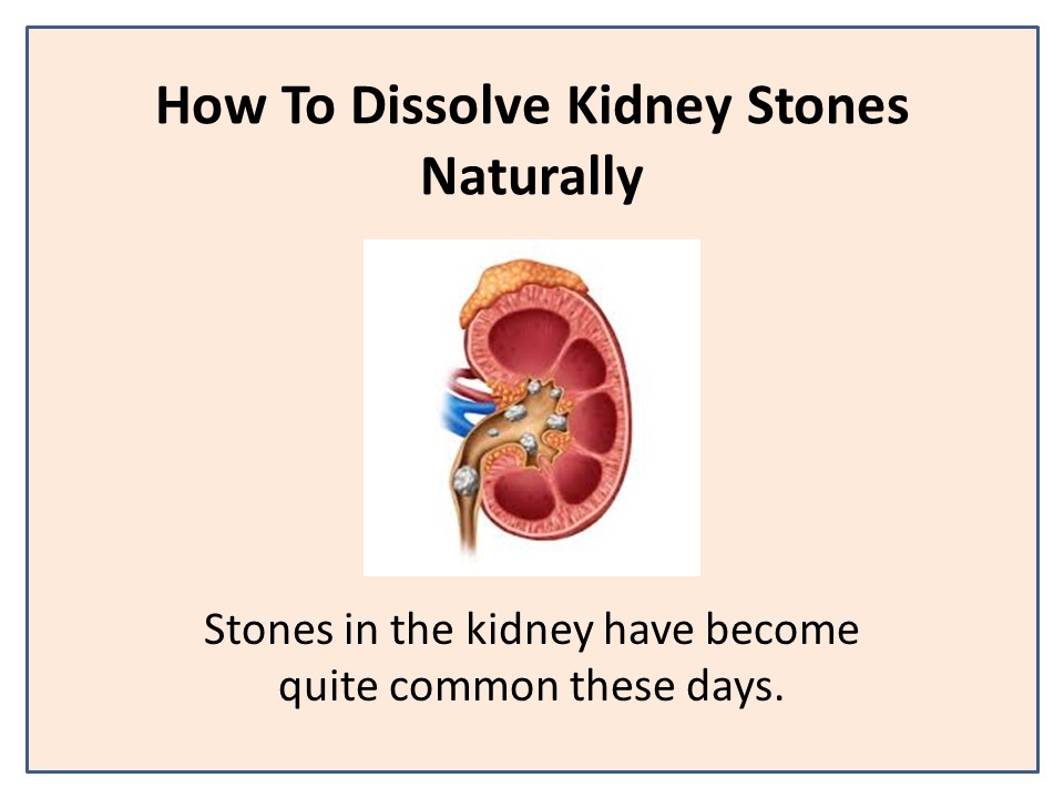 Kidney Stone