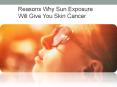 Reasons why sun exposure will give you skin cancer PowerPoint PPT Presentation