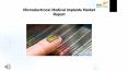 Microelectronic Medical Implants Market Research Report 2017 PowerPoint PPT Presentation