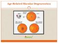 Age Related Macular Degeneration – Overview of Causes, Symptoms, Diagnosis, Risk factor, Prevention Treatment in India PowerPoint PPT Presentation