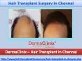 Hair Transplant Surgery in Delhi PowerPoint PPT Presentation