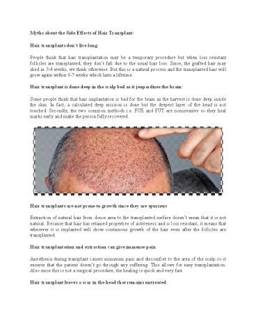 Myths about the Side Effects of Hair Transplant