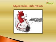 Myocardial infarction : Overview, Causes, Symptoms, treatment and diagnosis