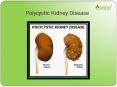 Polycystic kidney disease : Causes, Symptoms, Diagnosis, Complication and Treatment (1) PowerPoint PPT Presentation