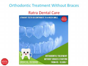 Orthodontic Treatment Without Braces