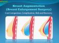 Breast Augmentation (Breast Enlargement Surgery) - Cost Comparison, Complication, Risk and Recovery