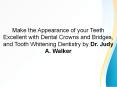 Make the Appearance of your Teeth Excellent with Dental Crowns and Bridges, and Tooth Whitening Dentistry by Dr. Judy A. Walker PowerPoint PPT Presentation