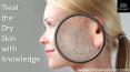 Treat your dry skin with knowledge PowerPoint PPT Presentation
