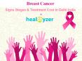 Know about Breast Cancer Stages at Healthyzer.com PowerPoint PPT Presentation