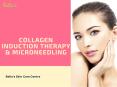 Know more about Collagen Induction Therapy & Microneedling PowerPoint PPT Presentation