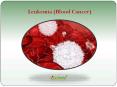 Leukemia (Blood Cancer) : Overview, symptoms, causes, diagnosis and treatment PowerPoint PPT Presentation