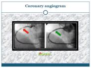 coronary angiogram