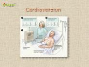 Cardioversion