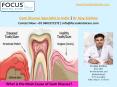 What is the Main Cause of Gum Disease | Gum Disease Specialist in Hyderabad, India PowerPoint PPT Presentation