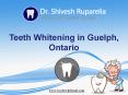 Teeth Whitening in Guelph, Ontario – Woolwich Dental Group PowerPoint PPT Presentation