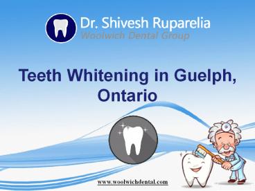Teeth Whitening in Guelph, Ontario – Woolwich Dental Group (1)