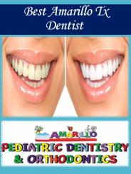 Best Amarillo Tx Dentist