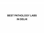Hepatitis b test labs in delhi